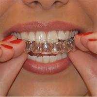 Clear Mouth Guard for Grinding Teeth, 2 Counts/set Reusable Mouth Guard for Sleeping at Night, Sports & Outdoor Accessories f...
