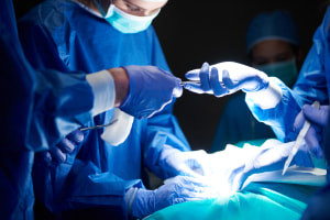CPT Surgery Coding