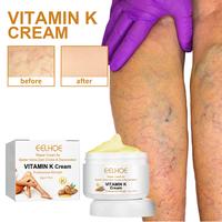 [Buy 1 Get 1 Free] Vitamin K Cream, 60g /2.11ozCirculheal VaricoseVeins Cream, Varicose Vein Cream.Remove Varicose.Veinsbody ...