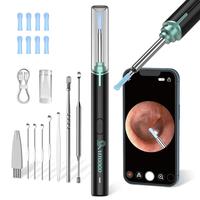 VITCOCO Can See Into The Ear Canal to Effectively Clean Earwax Tool