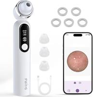 Blackhead Meter Vacuum for Face with Camera - Pore Remover for Men and Women, High-Definition 1080P Camera, 8 LED Lights, USB...