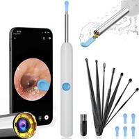 Sperax Portable Ear Wax Removal with Camera with HD Endoscope, Ear Wax Removal Tool, C-type charging, waterproof endoscope ea...
