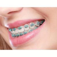 2025 Colorful Temporary Teeth Decorations |   Cosplay Braces with s & Stainless Steel |   Vibrant Party Style for Halloween, ...