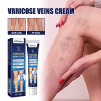 Venous massage Qu cream relieved leg bulge vessel Qu Zhang earthworm leg care Healthcare Treatment