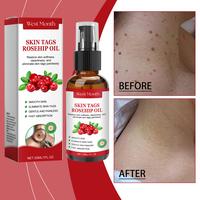 West&Month Rosehip Seed Verruca Essence Oil Fades Skin Tags Moisturizes Repairs Smoothes Skin