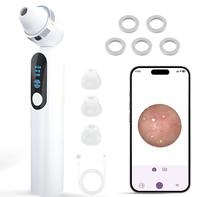 【Mosnami】Visible Exfoliator Vacuum Cleaner, Skin Scrubber with Camera, Pore Cleaner with Three Modes, USB Rechargeable, C...