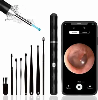 FONENYCA Ear Wax Removal Camera, Ear Cleaner 1296P HD Camera, Ear Cleaning Kit with 8pcs Ear Set, Wireless WiFi Otoscope with...