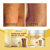 Vein Care Cream Relieve Leg Fatigue Improve Vein Circulation Gentle Horse Menthol Mild Moisture Moisturizers