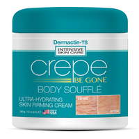 Crepe Be Gone Classic Body Souffle - New Larger 12 ounce - Moisturizers Comfort Skin Repair