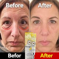 nstant Eye Bag Removal Cream Retinol Anti-Wrinkle Fade Fine Lines Firming Skin Anti Dark Circle Puffiness Brighten Eye Care