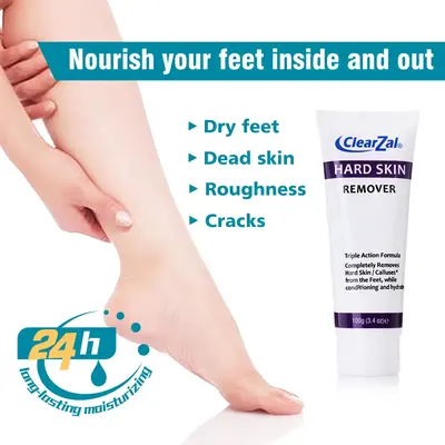Clearzal Dry Cracked Feet Repair UltraHydrating Hand and Foot Cream Crusty Moisturizer, 3.5 oz. Contains Urea, Salicylic Aci...