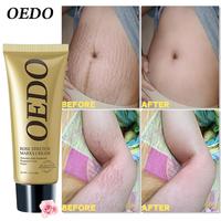 Stretch Mark Essential Removal Cream Pregnancy Repair Scar Slack Line Abdomen,rose Cream Eliminates Stretch Marks, Nourishes ...