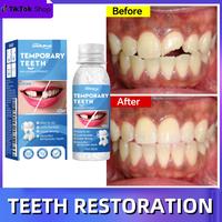 Resin Teeth Repair Glue – Moldable Temporary Tooth Filling & Broken Tooth Repair | Safe & Easy-to-Use Dental Gel for Gaps, ...