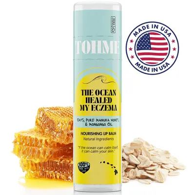 Nourishing Eczema Lip Balm with Ancient Mongongo Oil! Gentle, hydrating care for dry, cracked lips—perfect for sensitive sk...