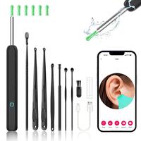 Ear Wax Removal Tool with Camera - Portable Type-C Rechargeable Earpick, Waterproof Endoscope with HD Camera, 360° Wide Angl...
