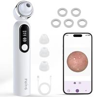 Fulog Blackhead Remover Vacuum, USB Interface Type Pore Vacuum, Black Head Extractions Tool with Camerafor, Women Pore Cleane...