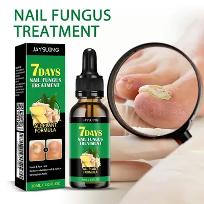 JAYSUING Ginger Nail Treatment – Vitamin E & Plant Extracts for Repairing Discolored, Damaged Nails, Dermatologist-Tested G...