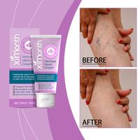 Vein Repairing Cream Relieve Leg Swelling Earthworm Leg Tension Massage Vein Body Care Cream Moisturizer Rosemary Moisture Mo...