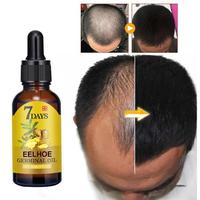 7 Day Fast Hair Growth Oil Ginger Growth Hair Treatment Anti Hair Loss Men Women Scalp Treatment Serum Products
