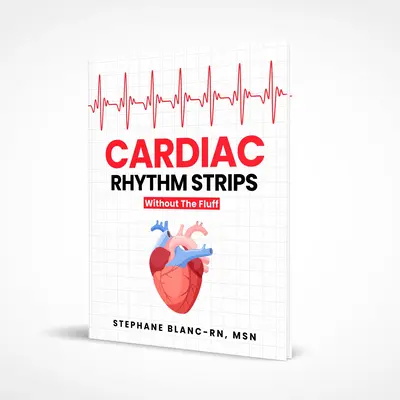 Cardiac Rhythm Strips Without The Fluff | Nursing Study Guide | ECG Interpretations