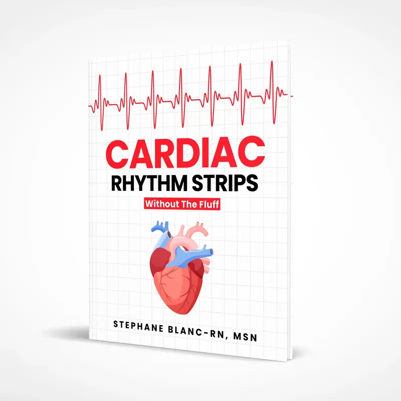 Cardiac Rhythm Strips Without The Fluff | Nursing Study Guide | ECG Interpretations