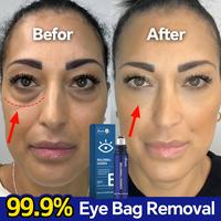 Anti-Aging Eye Serum | Used to eliminate dark circles, reduce eye puffiness, tighten eye skin and inhibit wrinkles.