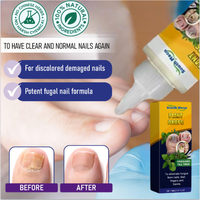 2025-Tea tree oil+Oregano oil ， nail support ，Healthy Nail Care， Instant Itch Relief  Nail Art Comfort Nail Polish Mani...