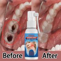 South Moon Toothache Relief Spray: Quick Relief for Toothaches,Cavities, Gum Swelling, and Oral Discomfort