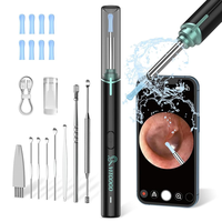 VITCOCO Ear Wax Removal Tool,Ear Cleaner with 1920P HD Camera,Ear Wax Removal Kits,Waterproof Otoscope with 6...