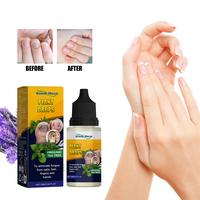 Anikila Hongo Anti-Fungus Nail Treatment - Nail Polish for Effective Nail Care Ginger treatment - springtok
