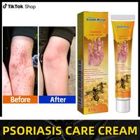 Psoriasis Cream – Soothing Itch Relief & Skin Repair | Moisturizing Treatment for Psoriasis, Eczema, Dry Hands & Feet