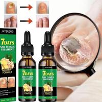 Exclusive Deal Ginger Nail Treatment Nail Serum 7 Days Nail Fungus Treatment for Nail Care